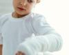 صحة وطب : 5 علامات تحذرك من إصابة الطفل بالكساح.. اعرفها واحميه